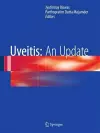 Uveitis: An Update cover