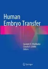 Human Embryo Transfer cover