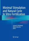 Minimal Stimulation and Natural Cycle In Vitro Fertilization cover