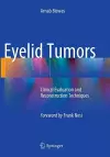 Eyelid Tumors cover