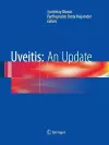 Uveitis: An Update cover