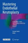 Mastering Endothelial Keratoplasty cover