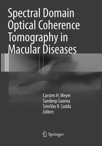 Spectral Domain Optical Coherence Tomography in Macular Diseases cover