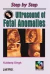 Step by Step Ultrasound of Fetal Anomalies cover