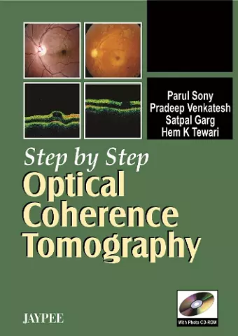 Step by Step: Optical Coherence Tomography cover