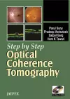 Step by Step: Optical Coherence Tomography cover