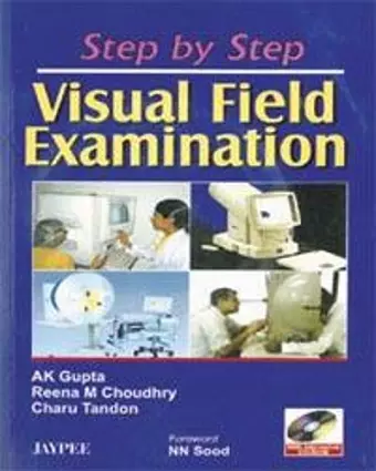 Step by Step: Visual Field Examination cover