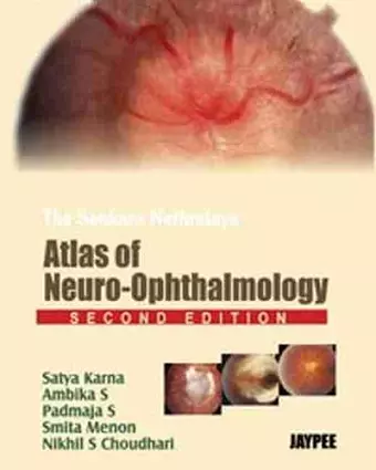 The Sankara Nethralaya's: Atlas of Neuro-Ophthalmology cover