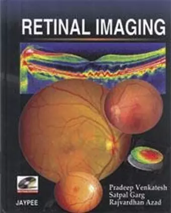 Retinal Imaging cover