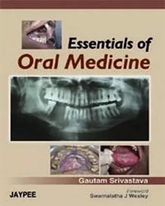 Essentials of Oral Medicine cover