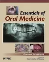 Essentials of Oral Medicine cover