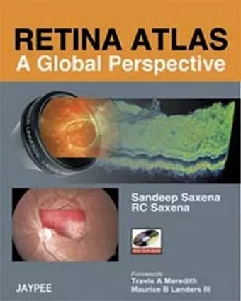 Retina Atlas - A Global Perspective cover