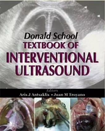 Donald School Textbook of Interventional Ultrasound cover