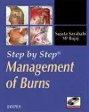 Step by Step: Management of Burns cover