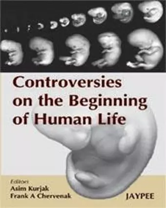 Controversies on the Beginning of Human Life cover