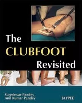 The Club Foot Revisited cover