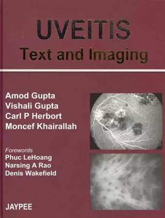 UVEITIS Text and Imaging cover