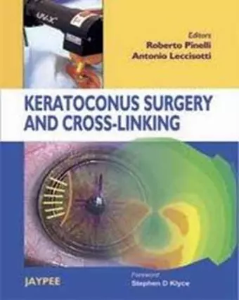 Keratoconus Surgery and Cross-linking cover