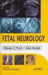Fetal Neurology cover