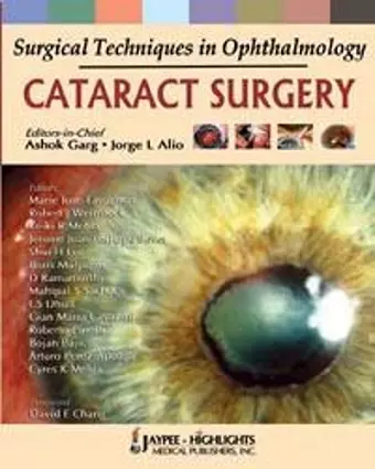 Surgical Techniques in Ophthalmology: Cataract Surgery cover