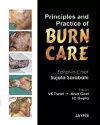 Principles and Practice of Burn Care cover