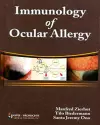 Immunology of Ocular Allergy cover