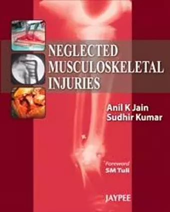 Neglected Musculoskeletal Injuries cover