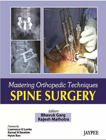 Mastering Orthopaedic Techniques Spine Surgery cover