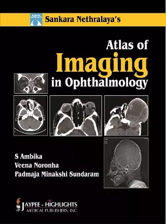 Atlas of Imaging in Ophthalmology cover