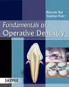 Fundamentals of Operative Dentistry cover