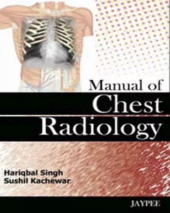 Manual of Chest Radiology cover