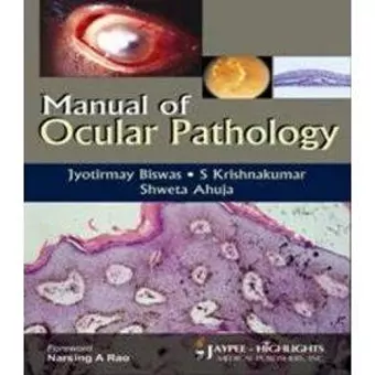 Manual of Ocular Pathology cover