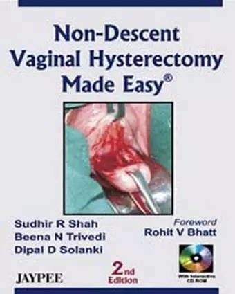 Non-Descent Vaginal Hysterectomy Made Easy cover