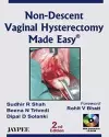 Non-Descent Vaginal Hysterectomy Made Easy cover