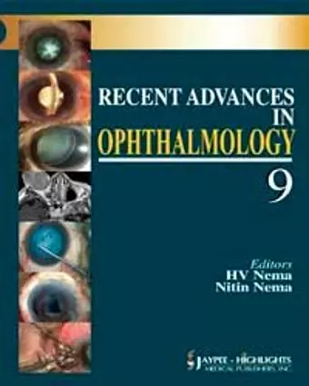 Recent Advances in Ophthalmology - 9 cover