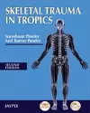 Skeletal Trauma in Tropics cover