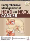 Comprehensive Management of Head and Neck Cancer cover