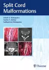 Split Cord Malformations cover