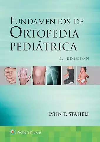 Fundamentos de ortopedia pediátrica cover