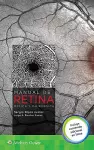 Manual de retina médica y quirúrgica cover