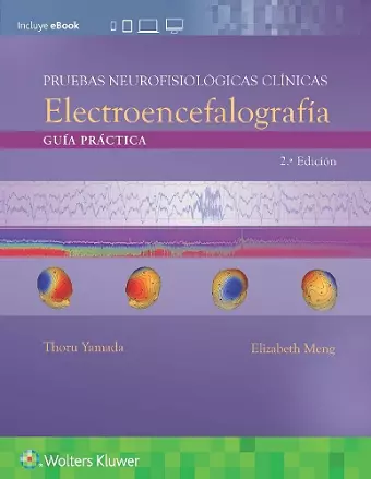 Pruebas neurofisiológicas clínicas. Electroencefalografía cover