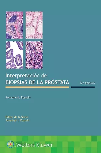 Interpretación de biopsias de la próstata cover