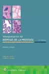 Interpretación de biopsias de la próstata cover
