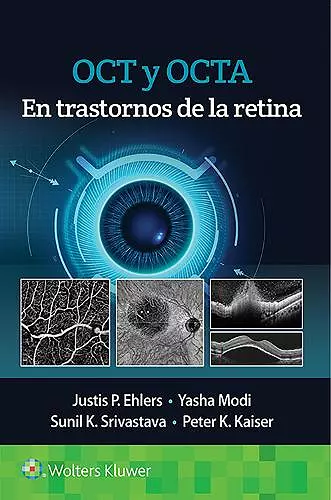 OCT y OCTA en trastornos de la retina cover