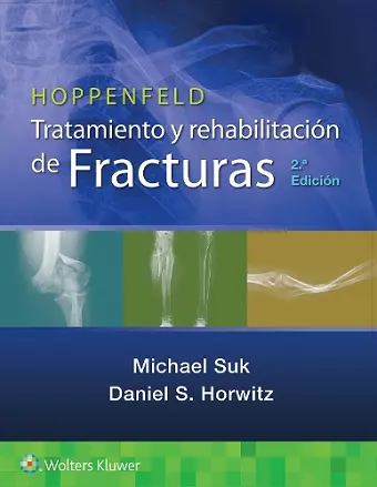 Hoppenfeld. Tratamiento y rehabilitación de fracturas cover