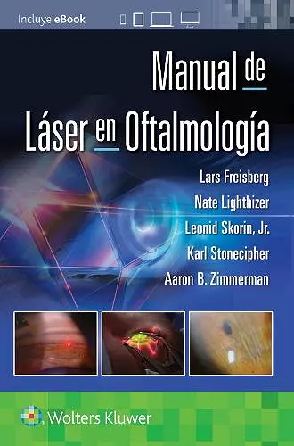 Manual de láser en oftalmología cover