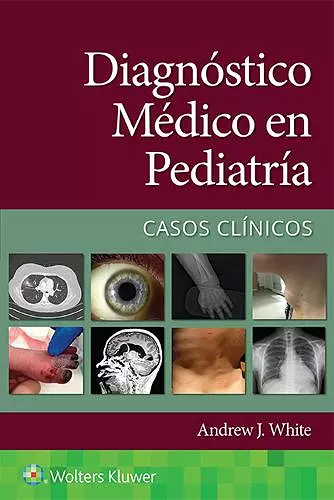 Diagnóstico médico en pediatría. Casos clínicos cover