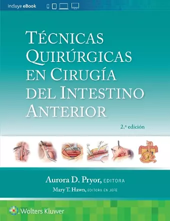 Técnicas quirúrgicas en cirugía del intestino anterior cover