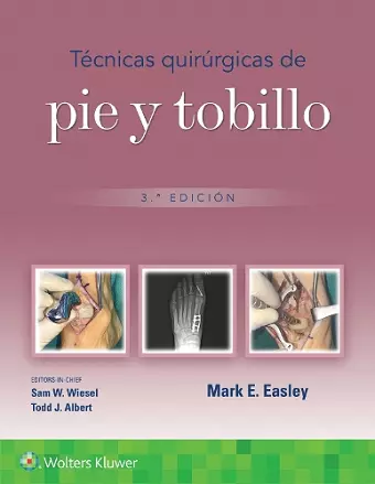 Técnicas quirúrgicas de pie y tobillo cover