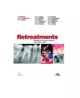 Retreatment. Solutions for apical diseases of endodontic origin cover
